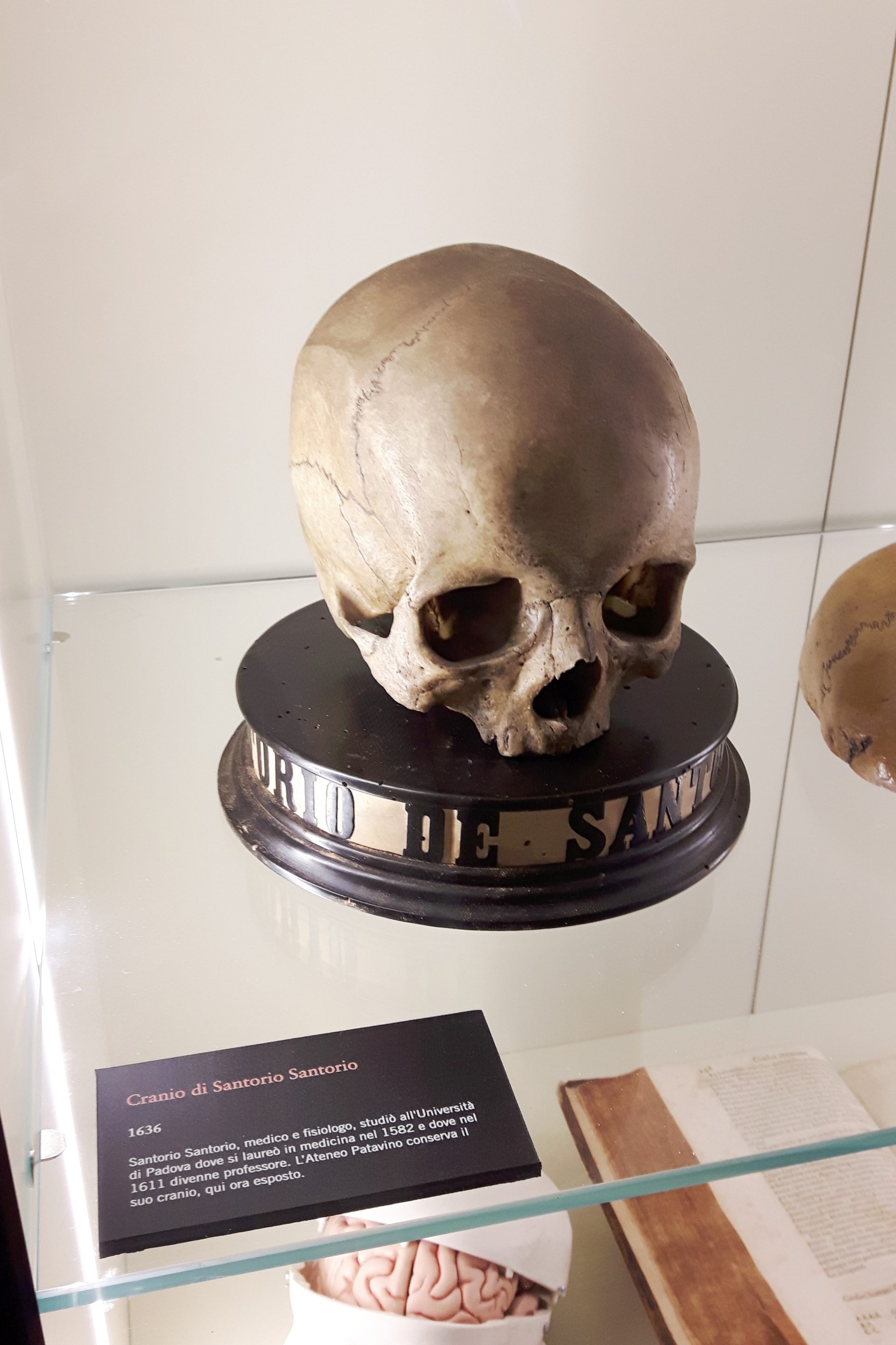 Santorio Santorio's skull, MUSME, Padua.jpg